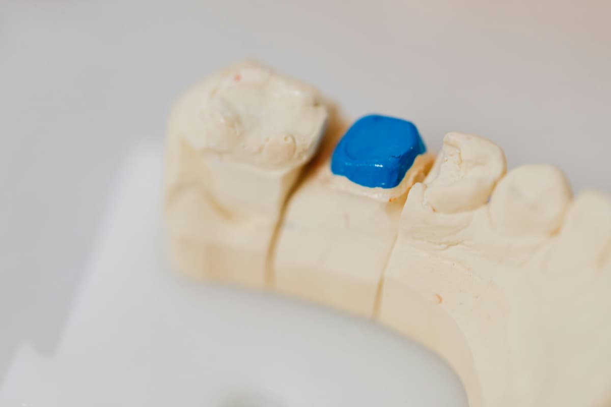 Dental fillings before and after